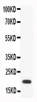 Anti-Macrophage Inflammatory Protein 4/CCL18 Antibody