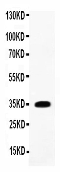 Anti-IL1 beta/IL1B Antibody