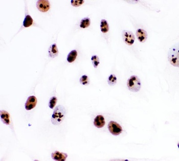 Anti-Ki67/MKI67 Antibody