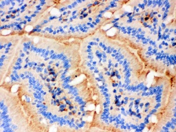 Anti-Actin ACTA1 Antibody (Monoclonal, AC-40)