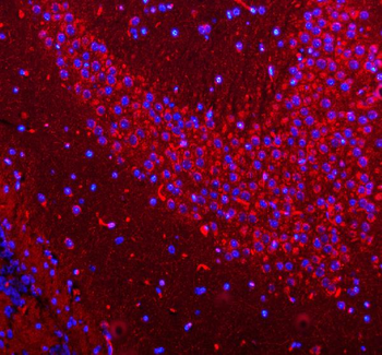 Anti-HCRT Antibody