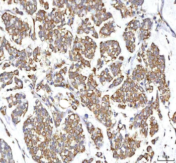 Anti-GOLGA7 Antibody