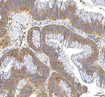 Anti-OCM Antibody