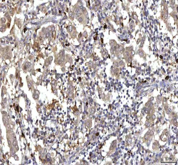 Anti-RASGRP3 Antibody
