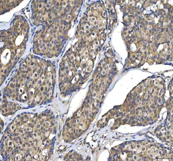 Anti-Huntingtin/HTT Antibody