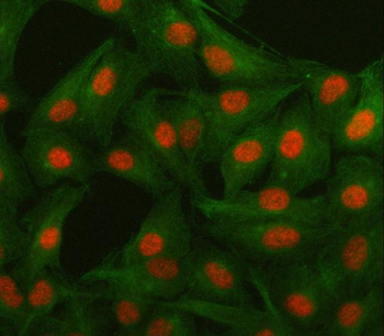 Anti-Islet 1/ISL1 Antibody