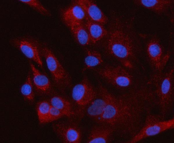 Anti-HSD3B7 Antibody