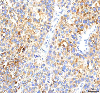 Anti-HEPACAM2 Antibody