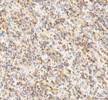 Anti-ISYNA1 Antibody