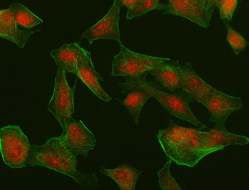 Anti-MUM1/IRF4 Antibody