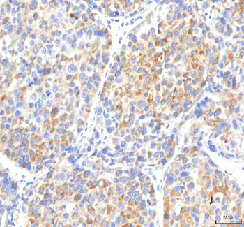 Anti-IPO8 Antibody