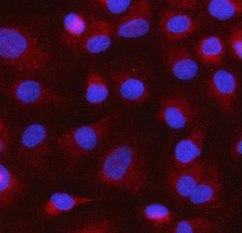 Anti-MOCS1 Antibody