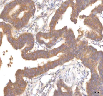 Anti-MFSD12 Antibody