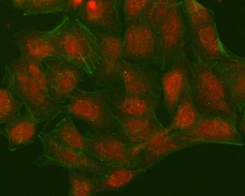 Anti-NUDT15 Antibody