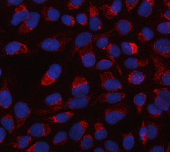 Anti-HTRA2 Antibody