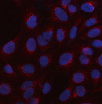 Anti-HTR3C Antibody