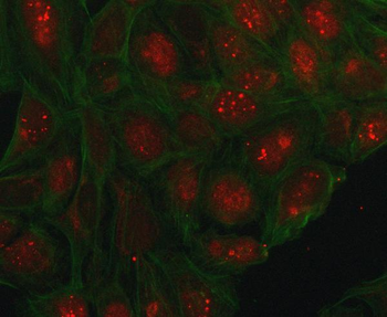 Anti-PHC1 Antibody