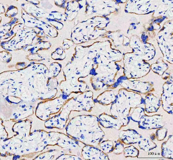 Anti-IDUA Antibody