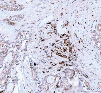 Anti-JCHAIN Antibody