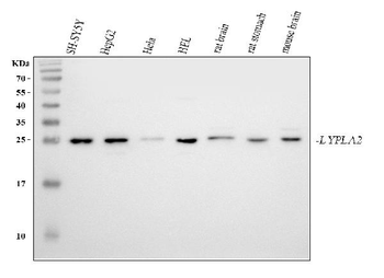 Anti-LYPLA2 Antibody