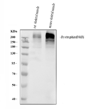 Dystrophin Dmd Antibody (Monoclonal, MANDYS8)
