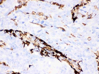 Gelsolin Gsn Antibody (Monoclonal, GS-2C4)