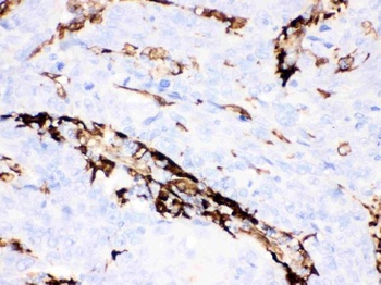 Anti-Gelsolin Gsn Antibody (Monoclonal, GS-2C4)