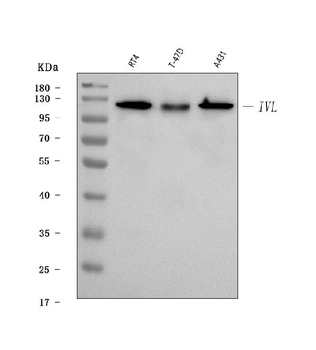 Anti-Involucrin Ivl Antibody (Monoclonal, SY5)