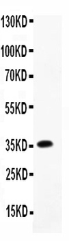 Anti-MCP3/CCL7 Antibody