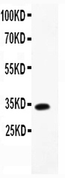 Anti-MCP4/CCL13 Antibody
