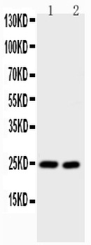 IL6 Antibody