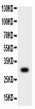 Anti-MMP7 Antibody