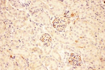 Anti-ACTH/POMC Antibody