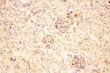 ACTH/POMC Antibody