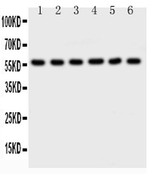 Anti-AKT2 Antibody