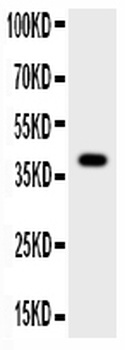 Cathepsin B/CTSB Antibody