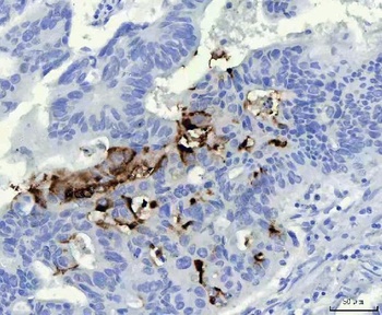 Mucin Gastric MUC5AC Antibody (Monoclonal, 45M1)