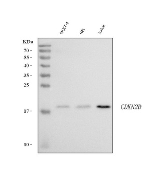 p19INK4d Cdkn2d Antibody (Monoclonal, DCS-100)