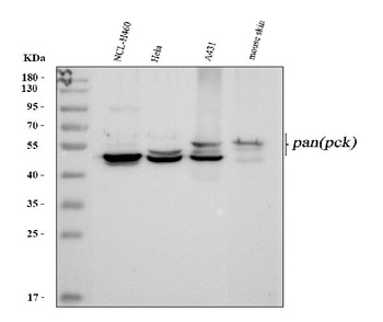 Anti-Pan cytokeratin Antibody (Monoclonal, PCK-26)