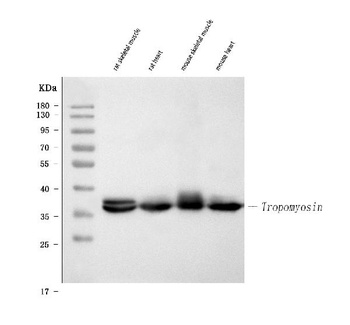Tropomyosin(36/39 kDa) Tpm1 Antibody (Monoclonal, TM31)