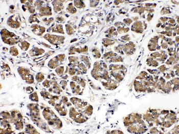 Anti-Amylase/AMY1A/AMY1B/AMY1C Antibody