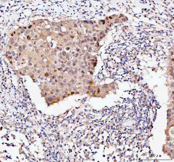 Anti-Bag1 Antibody