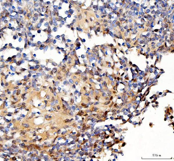 Anti-Survivin/BIRC5 Antibody