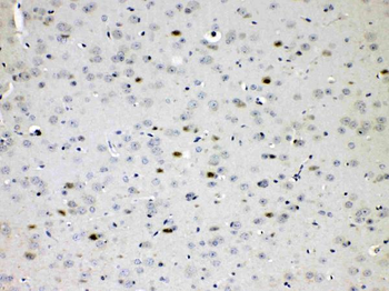 Anti-Choline Acetyltransferase/CHAT Antibody