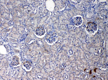 Anti-C Reactive Protein/Crp Antibody