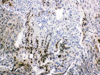 Anti-FABP2/I-FABP Antibody