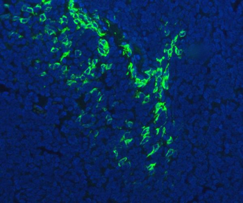 Anti-FDCSP Antibody