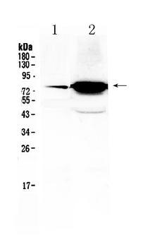 Anti-FSH Receptor/FSHR Antibody