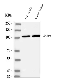 Anti-GABA B Receptor 1/GABBR1 Antibody