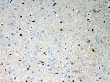 Anti-HCN2 Antibody